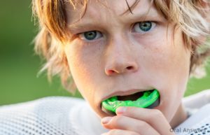 Athletic Mouth Guards