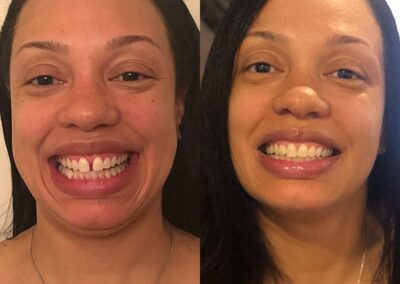 candidpro results falifia b