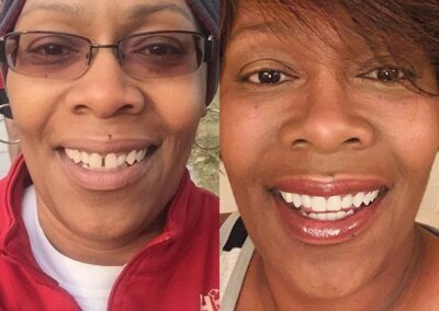 candidpro results quinne d